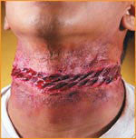 Reel F/X Noosed  Prosthetic